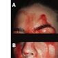 171023181928-01-sweating-blood-case-study-exlarge-169